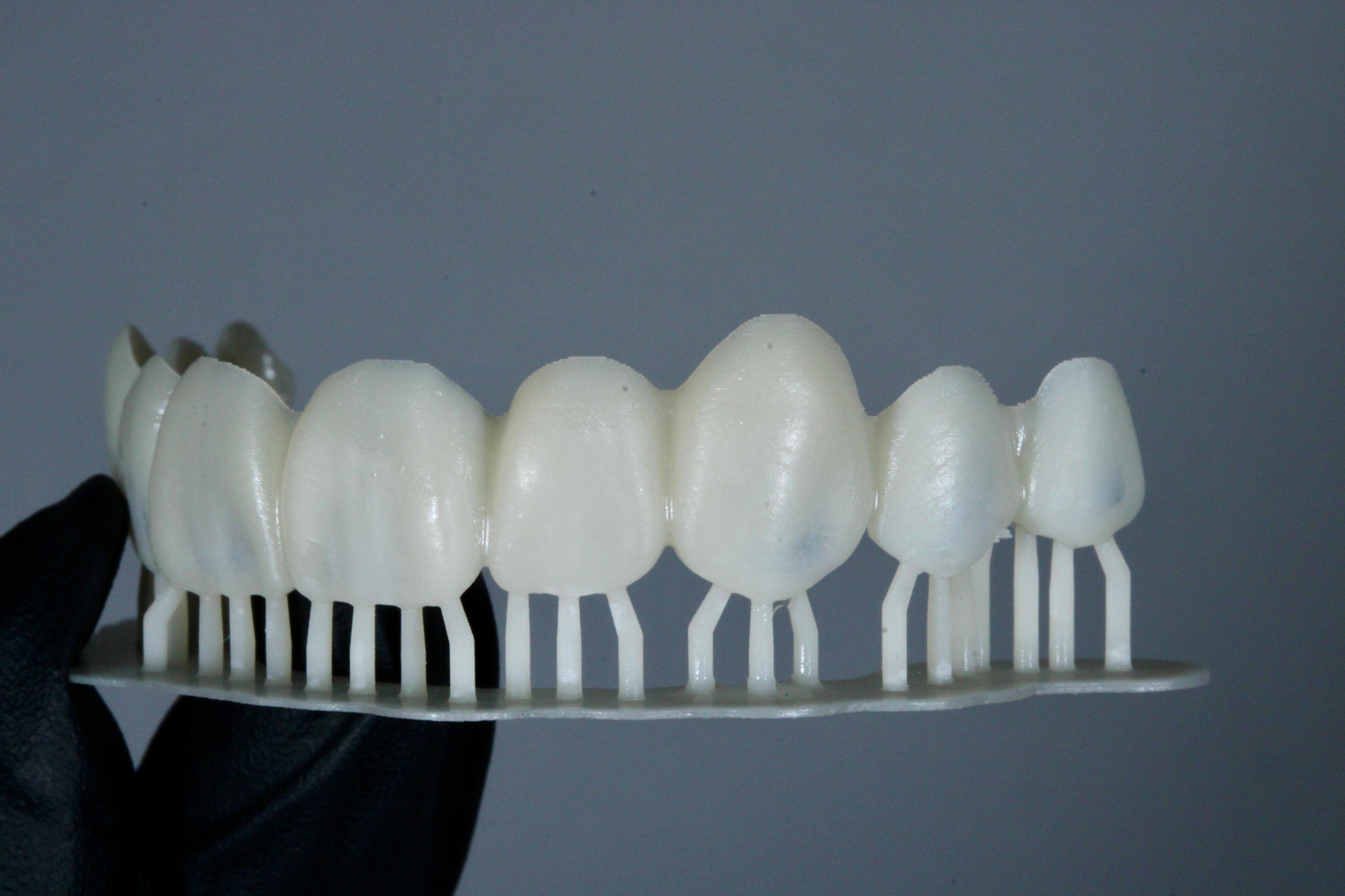 Snap-on impreso en 3D